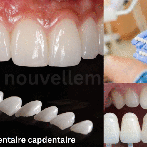 ceramique dentaire capdentaire